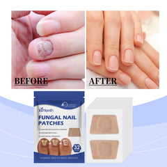 Ximonth Nail Care Patches Gently Repair Nails For Easy Daily Cleaning With Simple Care Patches DC-Funny Candle Co